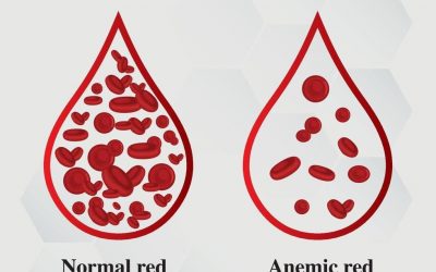 Tingginya Prevalensi Anemia, Dosen Ankes Unusa Lakukan Deteksi Dini Menggunakan POCT